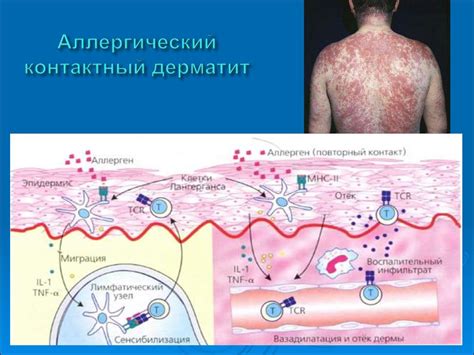 Аллергические реакции и раздражения