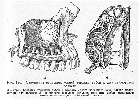 Анатомия верхней стенки пазухи