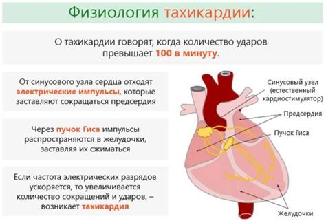 Аритмия и тахикардия: различия и сходства