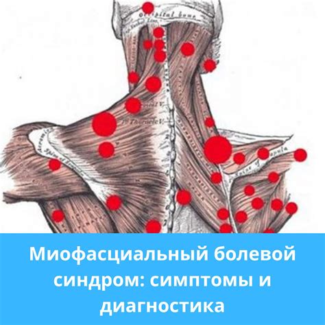 Болевой синдром и отек