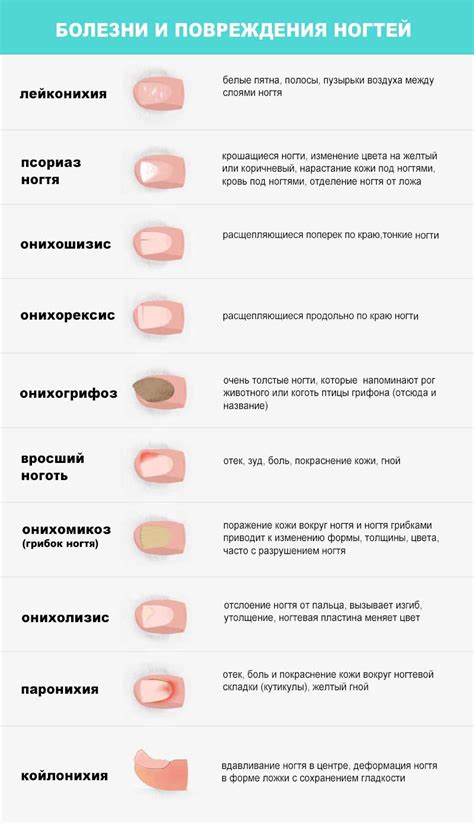 Болезни ногтей и организма в целом