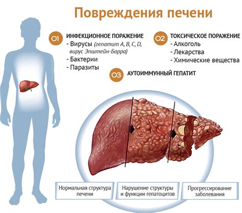 Болезни печени