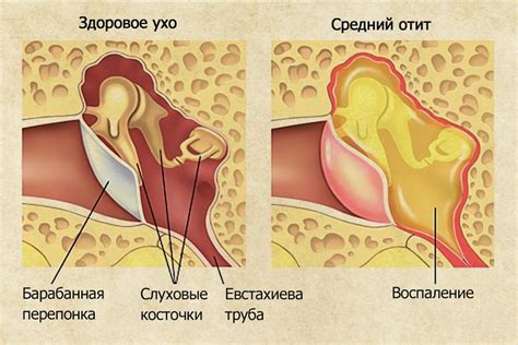 Боль при глотании