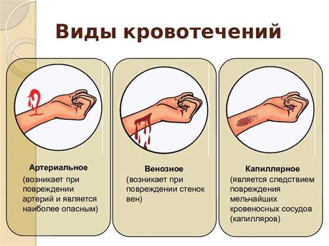 Важность понимания значения знака «остановка крови другому человеку»