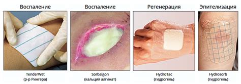 Важность правильного ухода: как быстро закрыть рану после травмы во время принятия душа