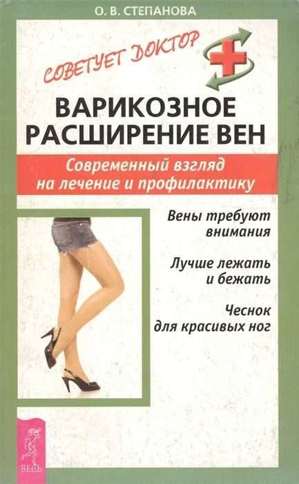 Варикозное расширение вен: факторы риска и методы борьбы