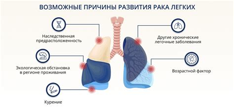 Взаимосвязь аллергии и покалывания в легких: как определить причину