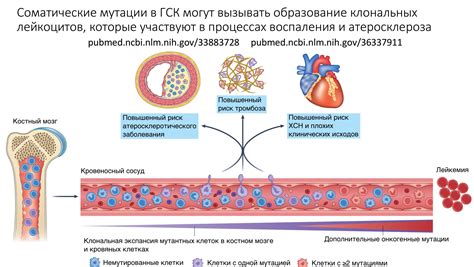 Взаимосвязь с другими сердечными заболеваниями