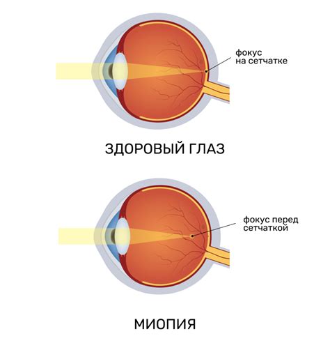 Виды и симптомы глазных проблем