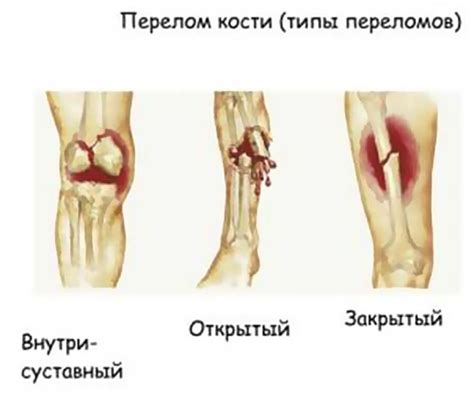 Виды тяжелых травм с различной локализацией