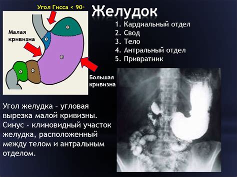 Визуализация контраста во время КТ-диагностики желудочно-кишечного тракта