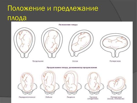 Визуализация ограничена положением плода - причины и последствия