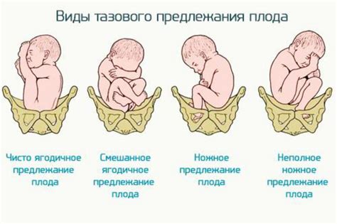 Влияние естественного положения плода на визуализацию