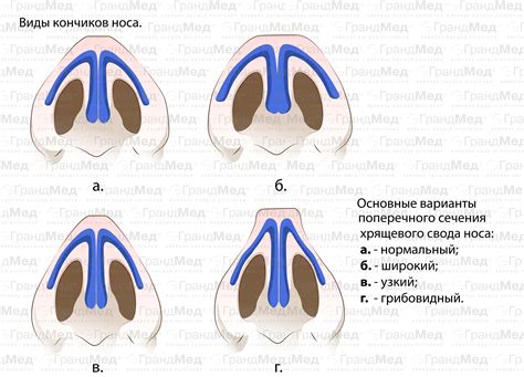 Влияние структуры носа на внешний вид