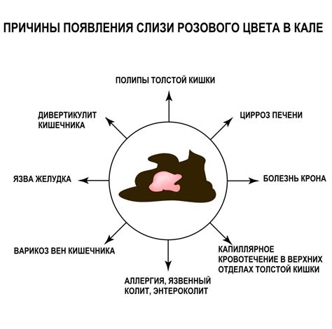 Внутренние причины появления слизи в кале