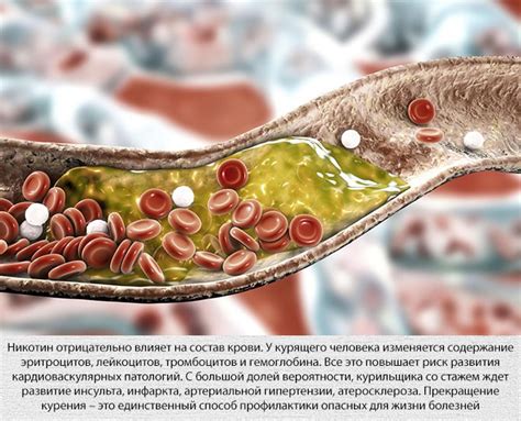 Воздействие никотина на кровь и кровеносную систему