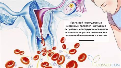 Возможность нерегулярных месячных