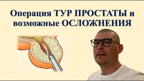 Возможные осложнения и риски биопсии простаты