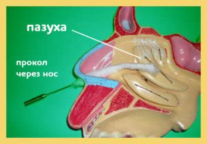 Возможные осложнения после прокола хряща