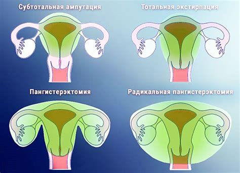 Возможные последствия удара в матку для женщины