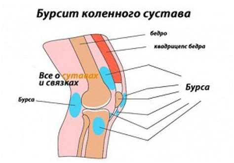 Воспаление сустава или его окружающих тканей