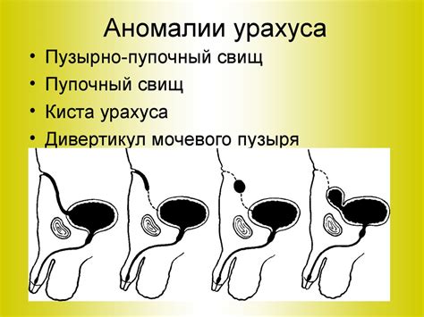 Врожденные аномалии и выделение из пупка