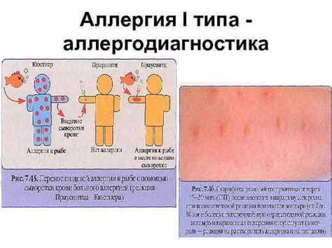 Выявление аллергических реакций