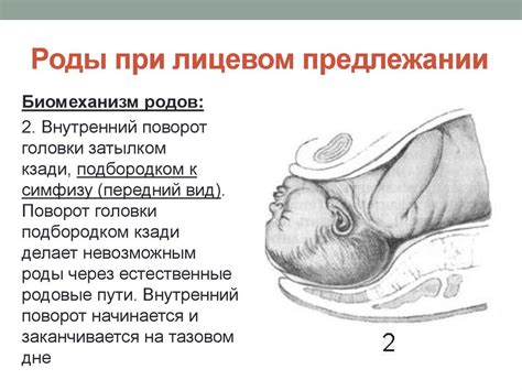 В переднем виде затылочного предлежания: симптомы, причины и лечение