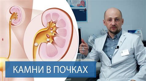 В чем опасность колик в почках?