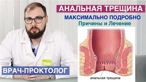 Геморрой и трещины