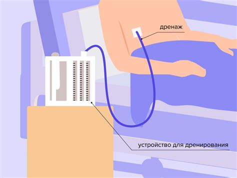 Гигиена и уход после операции на легком