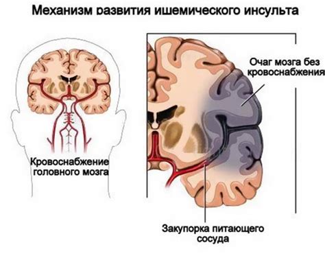 Гипоксия головного мозга у ребенка