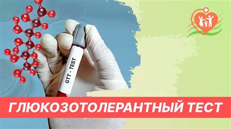 Глюкозотолерантный тест - подготовка и методика проведения