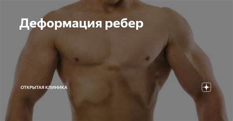 Деформация ребер