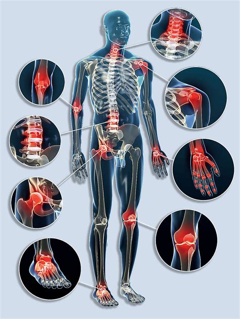 Диагностика болей в суставах