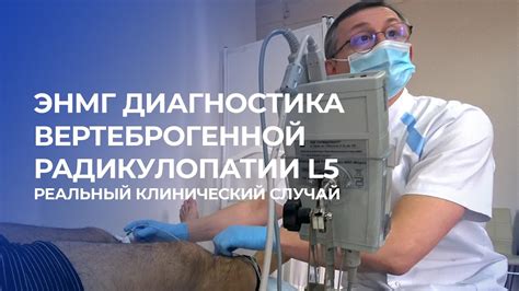 Диагностика вертеброгенной цервикобрахиалгии слева