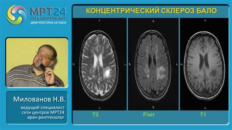 Диагностика диффузии головного мозга