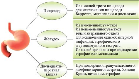 Диагностика и классификация изъязвления слизистой оболочки ЖКТ