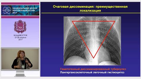 Диагностика остеобластических очагов