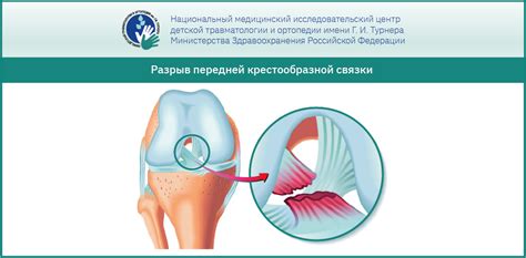 Диагностика повреждения