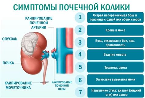 Диагностика почечной колики у женщин