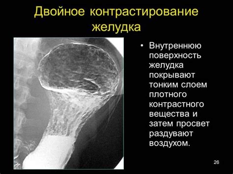 Диагностика синдрома гиены бары и методы установления диагноза