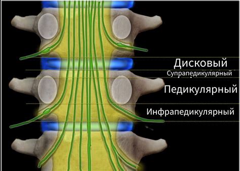 Дискоостеофитический комплекс: общие сведения