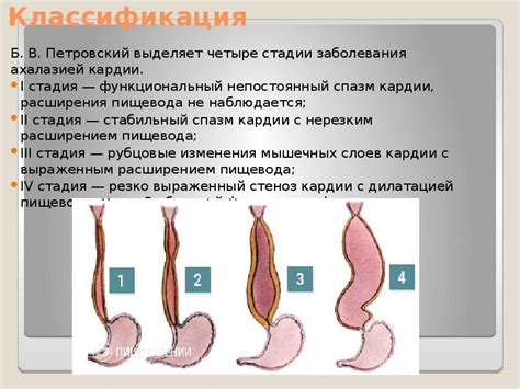 Заболевания и повреждения пищевода