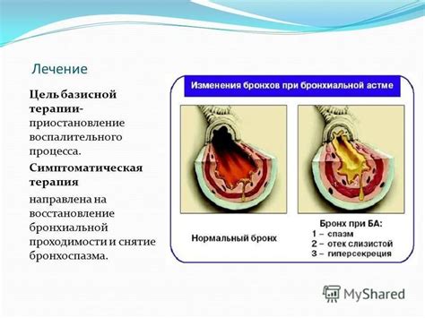 Завершение воспалительного процесса и восстановление гемостаза