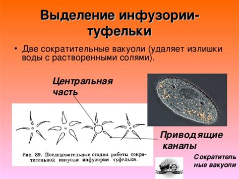 Зачем инфузории нужны туфельки