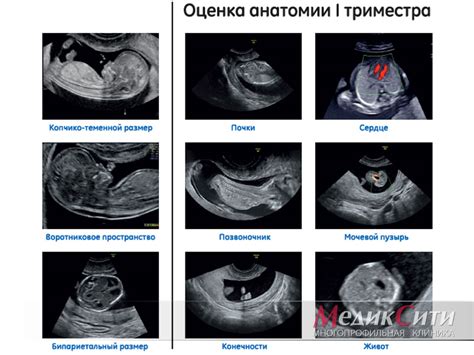 Значение движения ребенка на КТГ