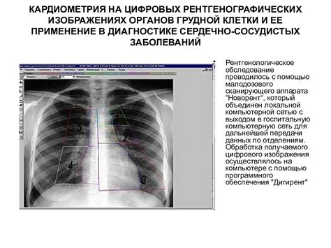 Значение контраста при исследовании сердечно-сосудистой системы