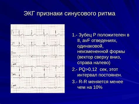 Значение основного ритма синусового на холтере