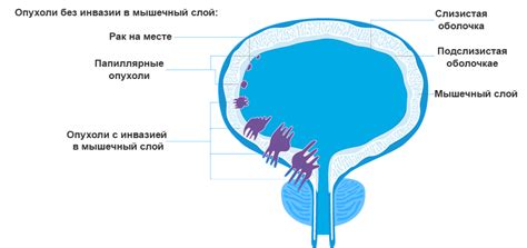 Значение содержимого мочевого пузыря